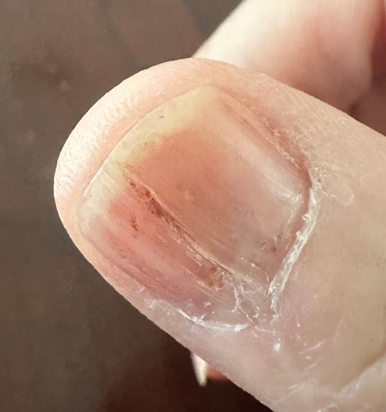 Customer photo review of Brain-Belly-Body Elixir Mixer Powder