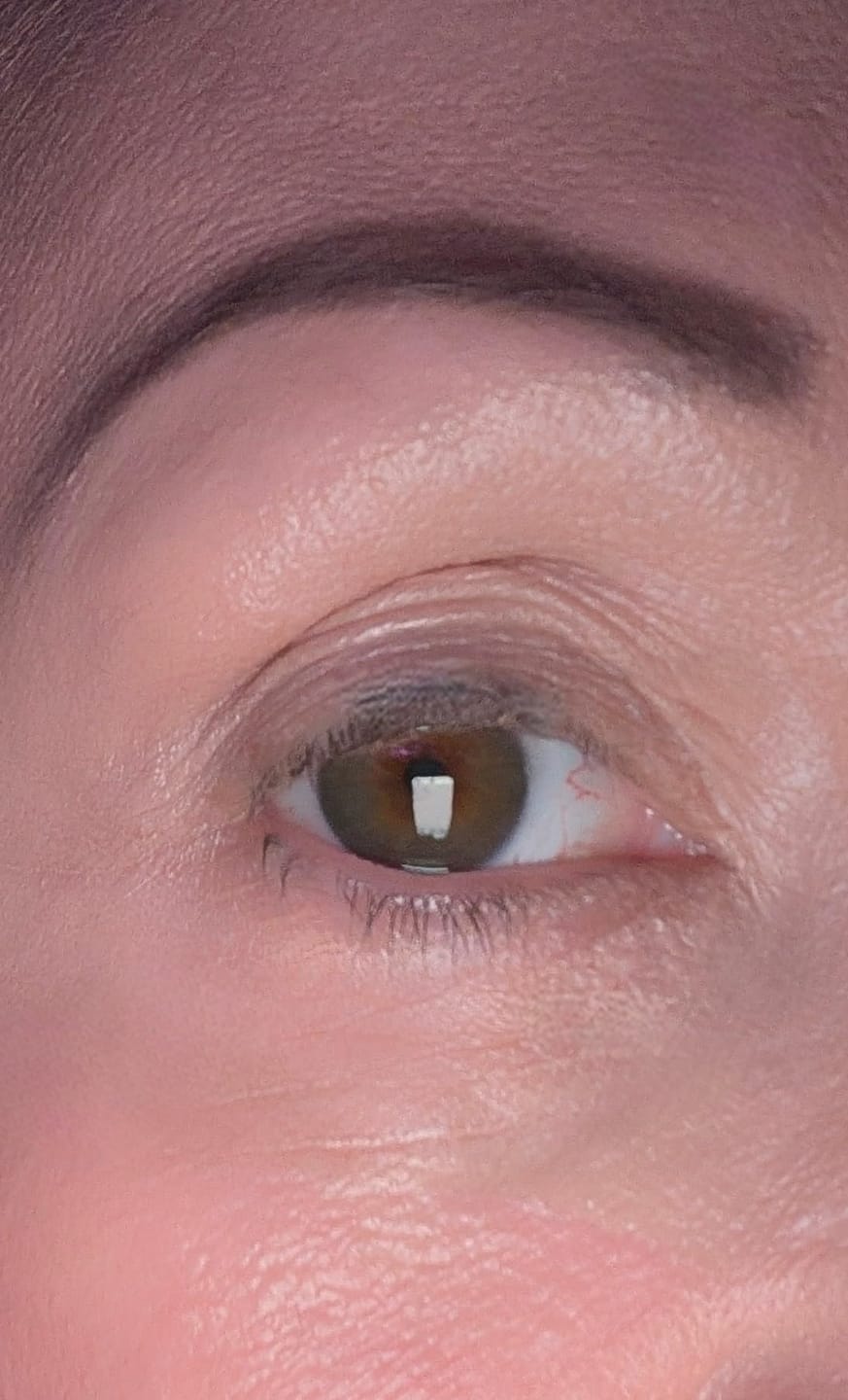 Customer photo review of Organix™ - Instant Puffy Under Eye Bag Remover Cream