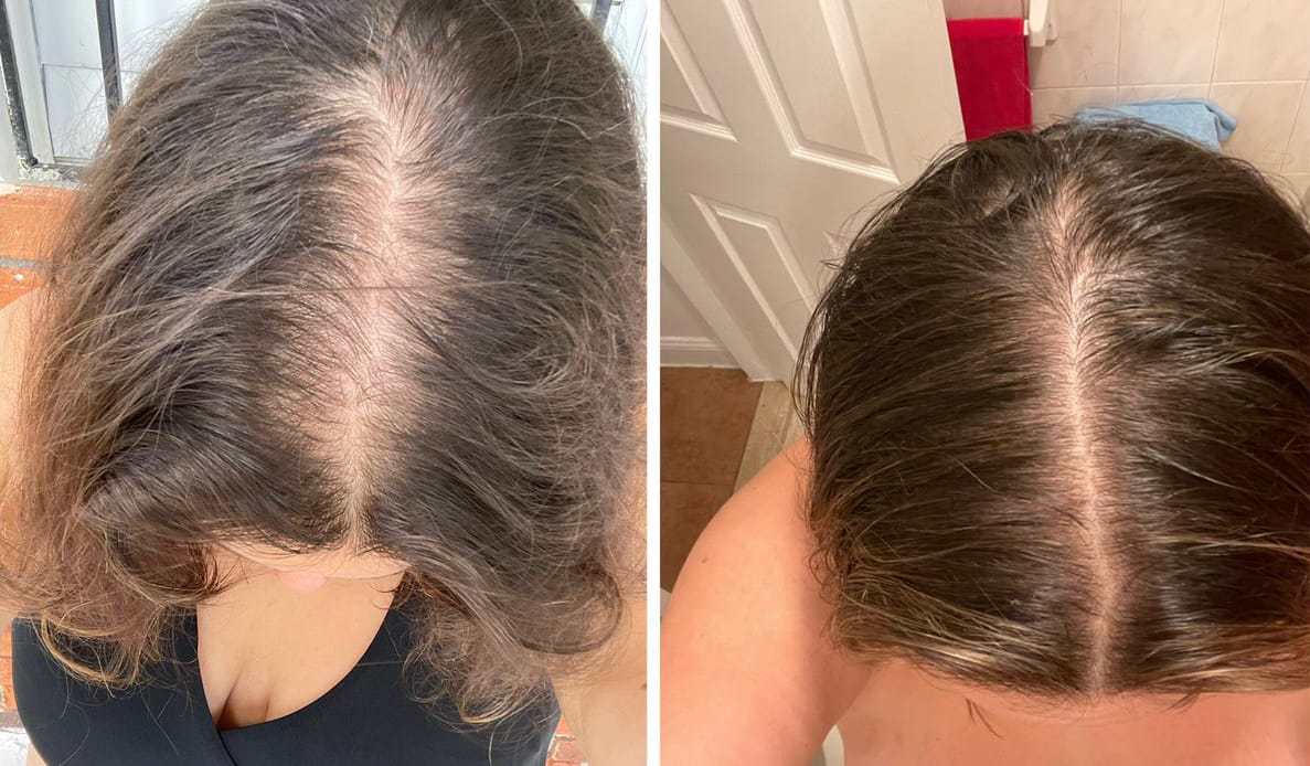 Customer photo review of PDRN Shoot Brush 2x1 Oferta