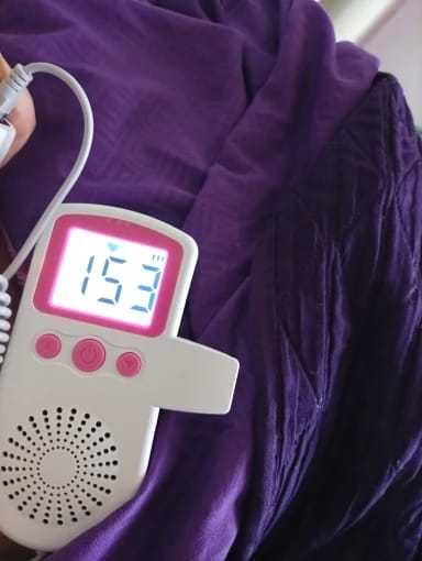 Customer photo review of Babylatido™ - Escucha el latido de tu bebé❤️