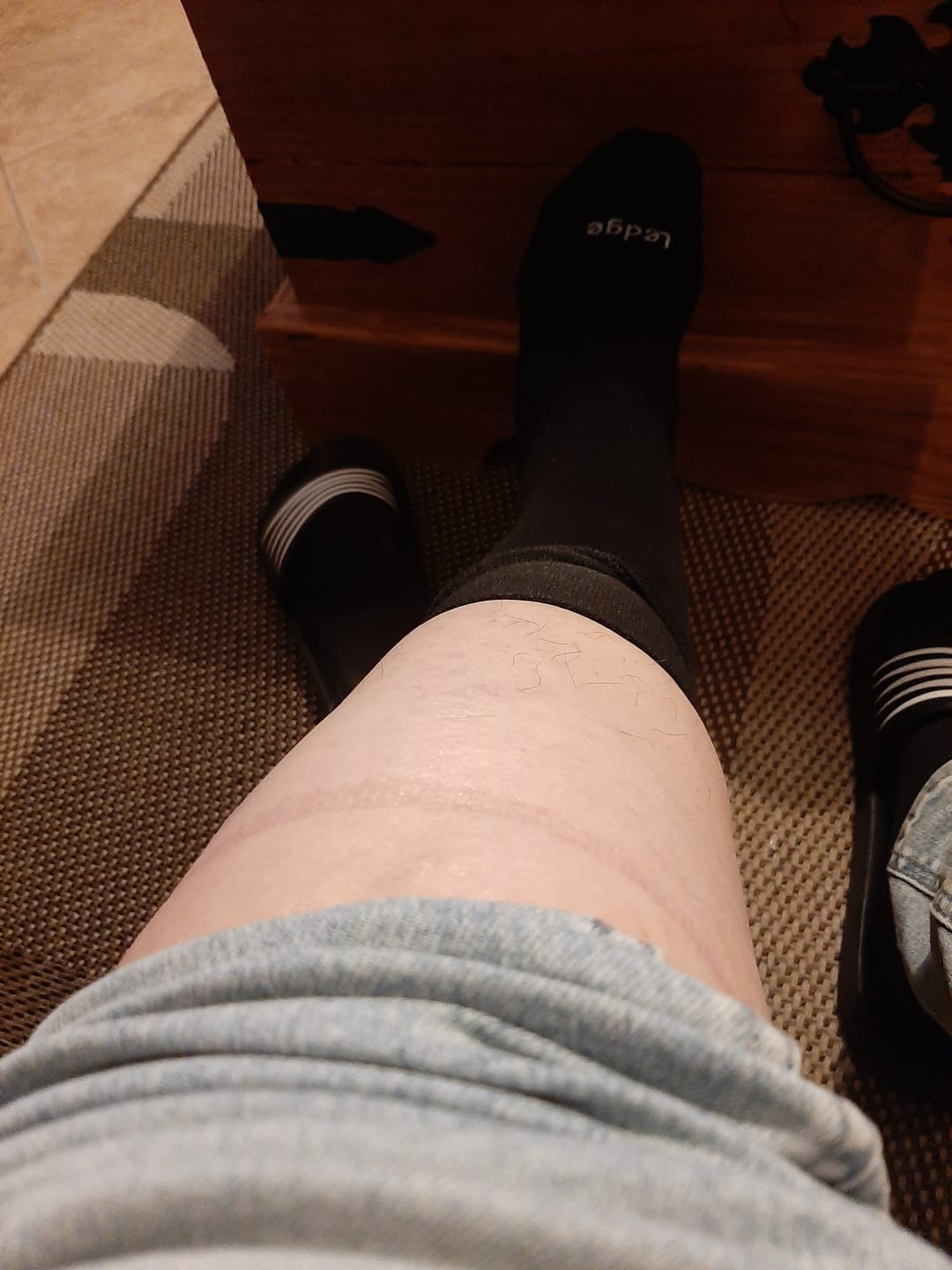Customer photo review of Essential Compression Socks Black