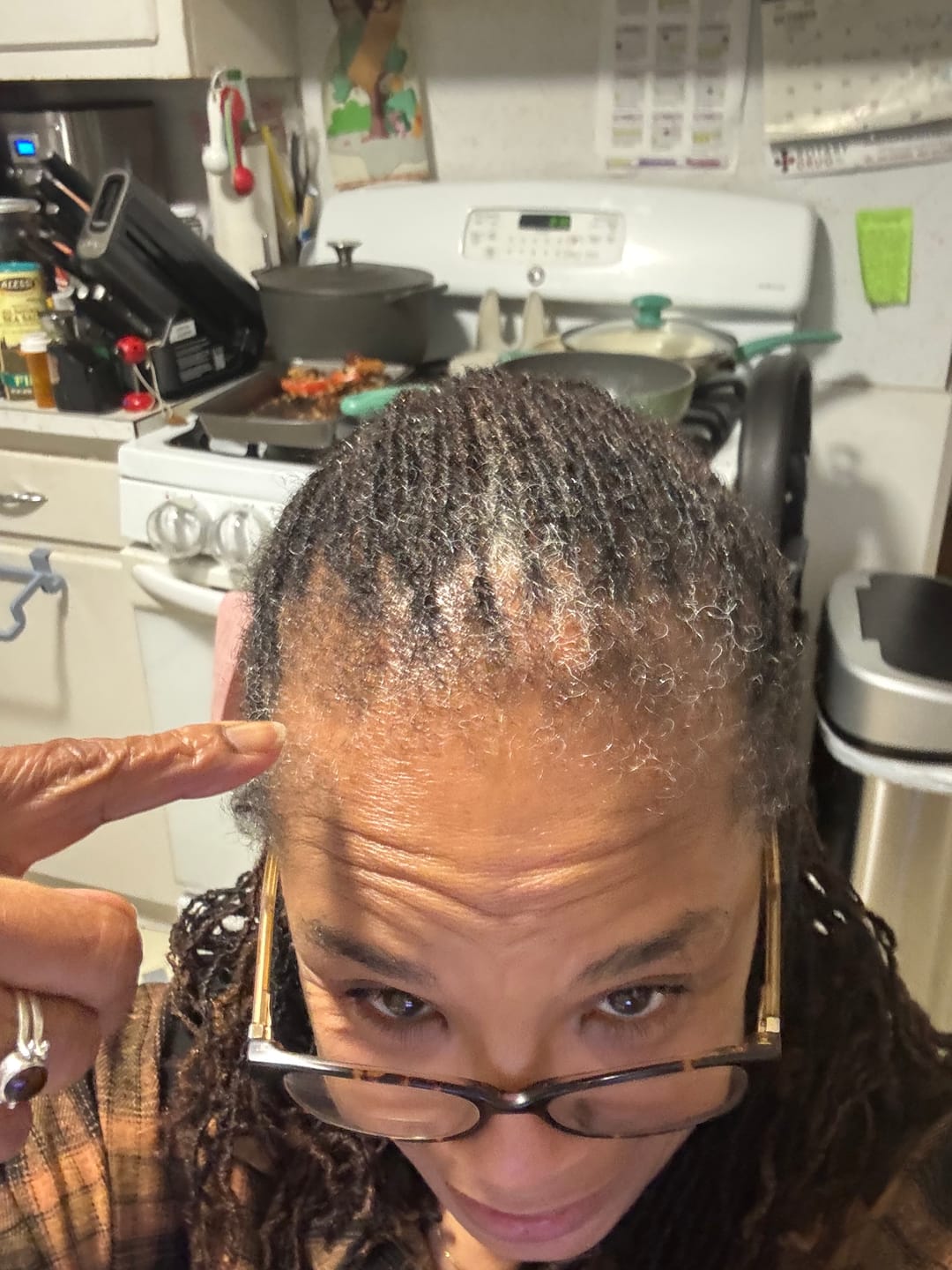 Customer photo review of Scalp Therapy System