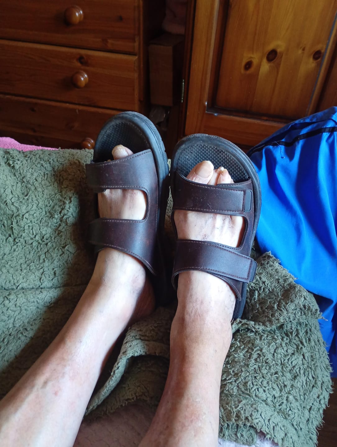 Customer photo review of Rowan | Orthopedic Walking Sandals