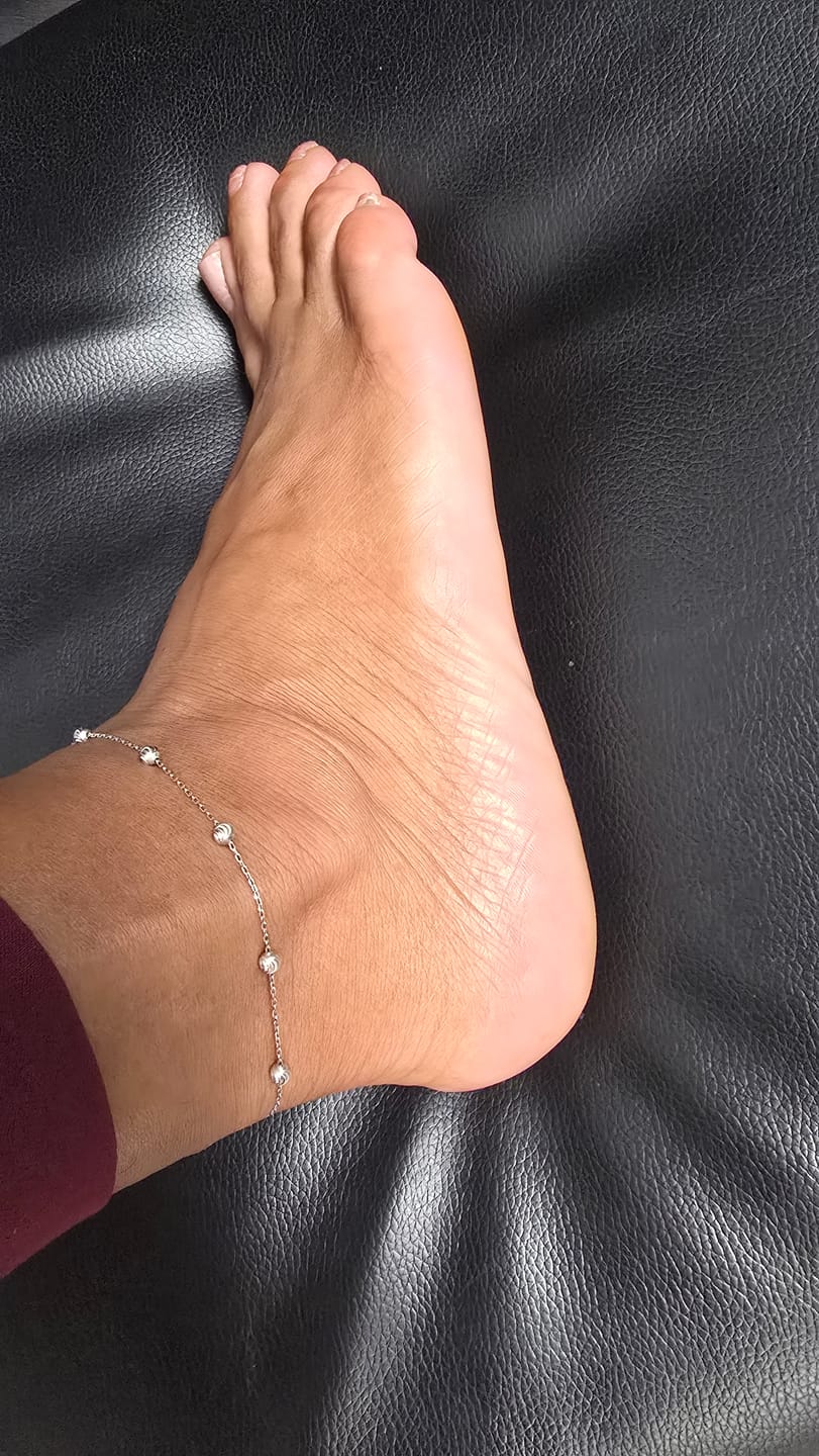 Customer photo review of Foot Balm