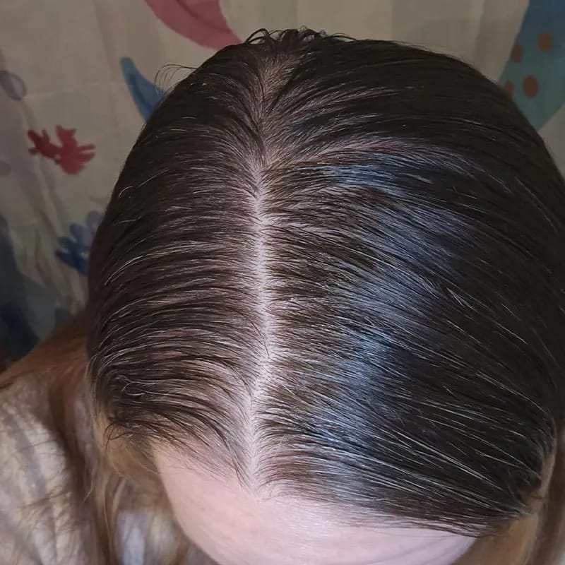 Customer photo review of PDRN Brush Hair Serum