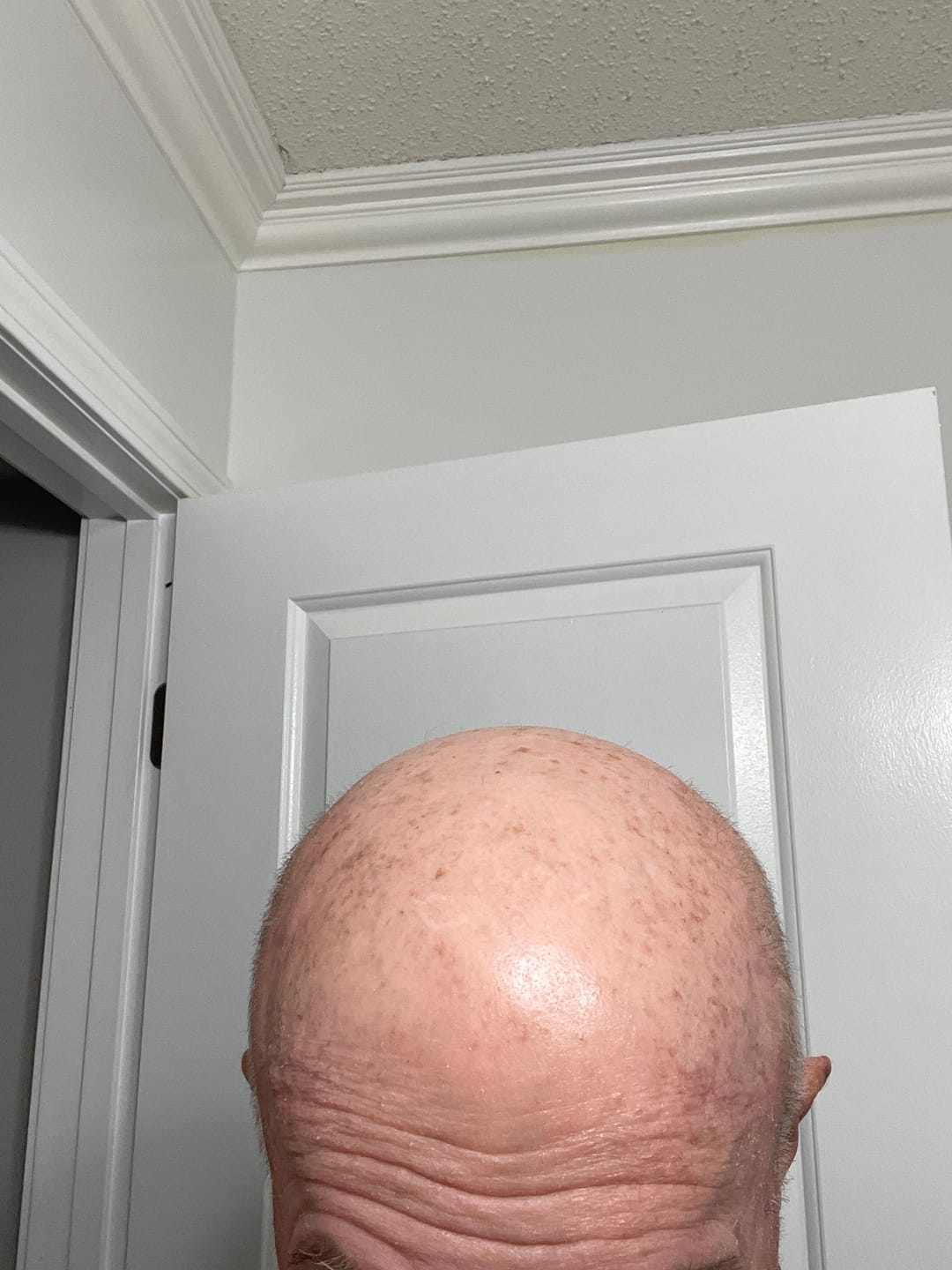 Customer photo review of Spartan™ Root Activator Shampoo 6 Bottles(sc)
