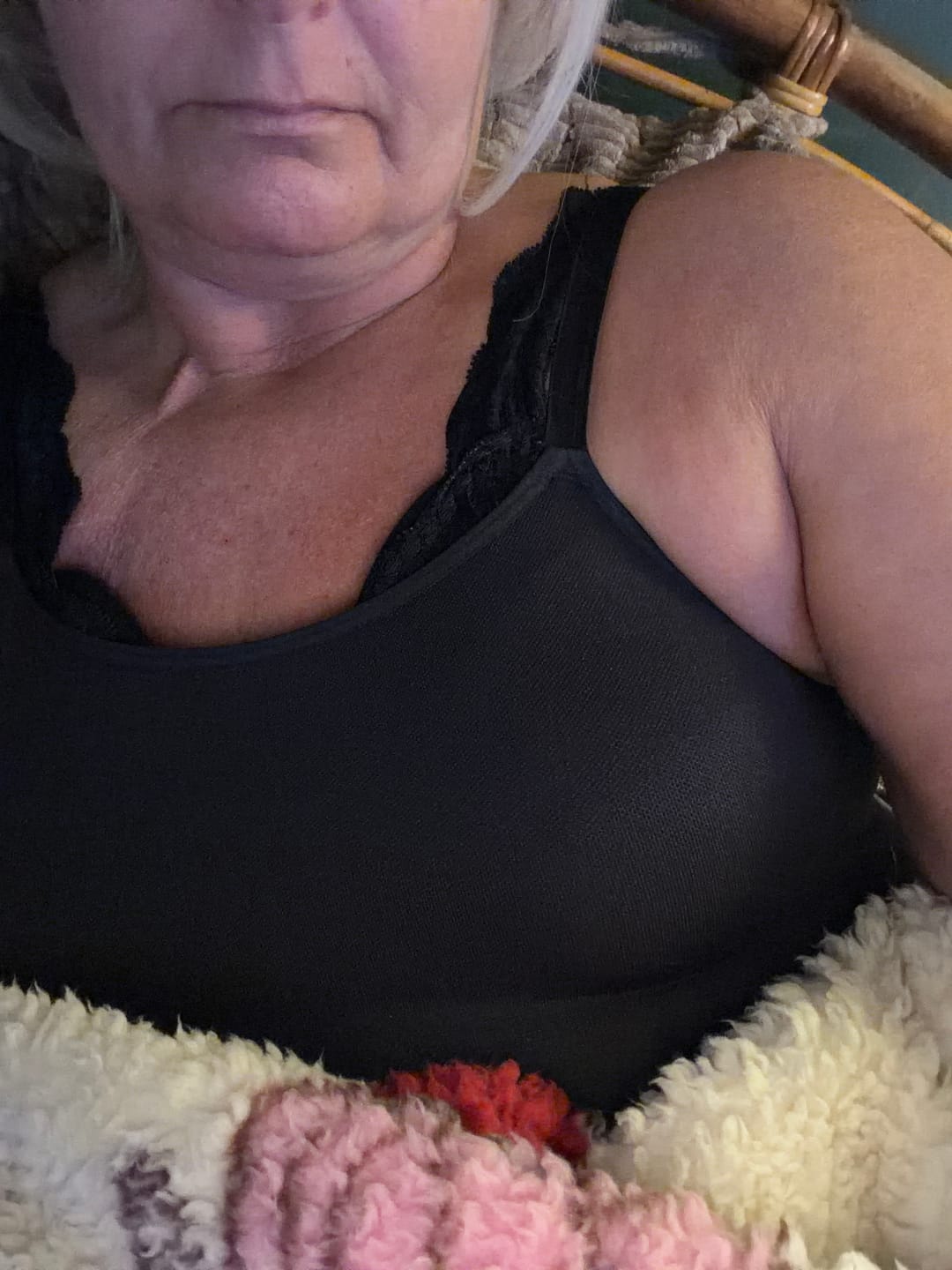 Customer photo review of Breast Implant Sizer - Single Pair