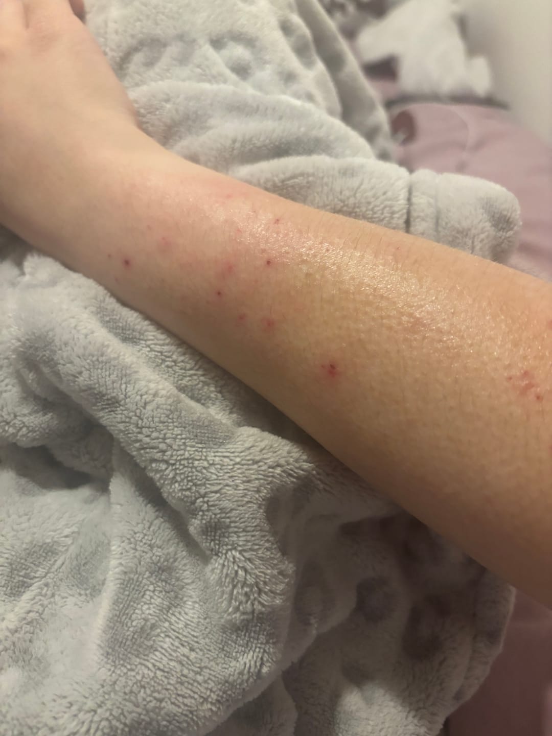 Customer photo review of Smiles & Joys Eczema and Psoriasis Herbal Cream