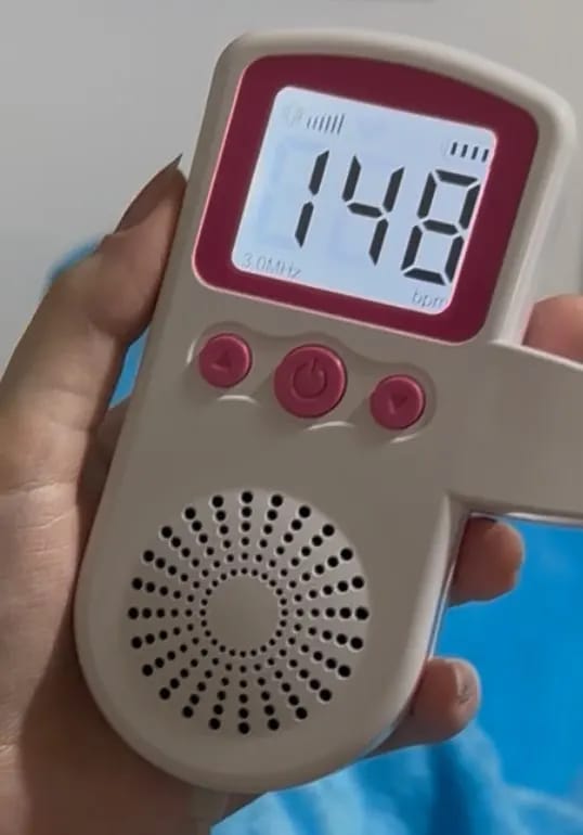 Customer photo review of Babylatido™ - Escucha el latido de tu bebé❤️