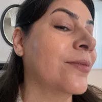 Customer photo review of [Dr.Melaxin Exclusive] Radiant Blowout Routine Set