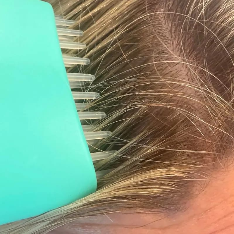 Customer photo review of PDRN Brush Hair Serum