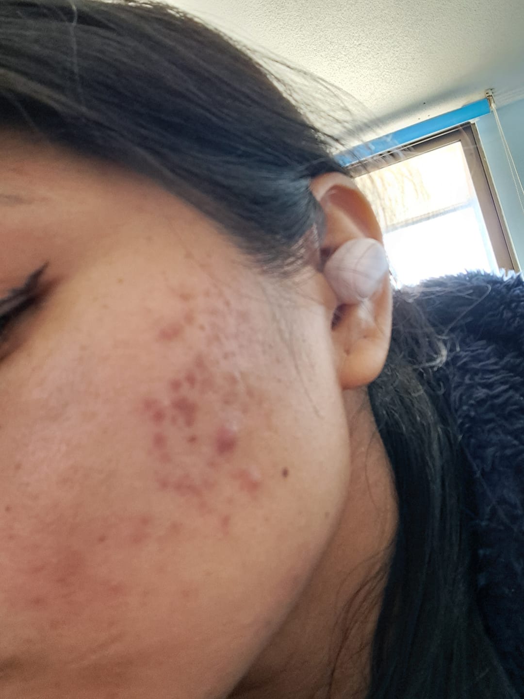 Customer photo review of Sérum Facial Despigmentante Anti Manchas AMPLEN 30ml