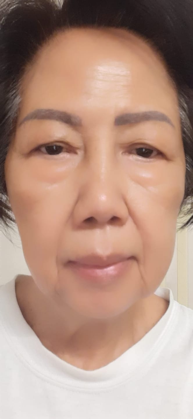 Customer photo review of Sea Cucumber Collagen Instant Lift Eye Serum