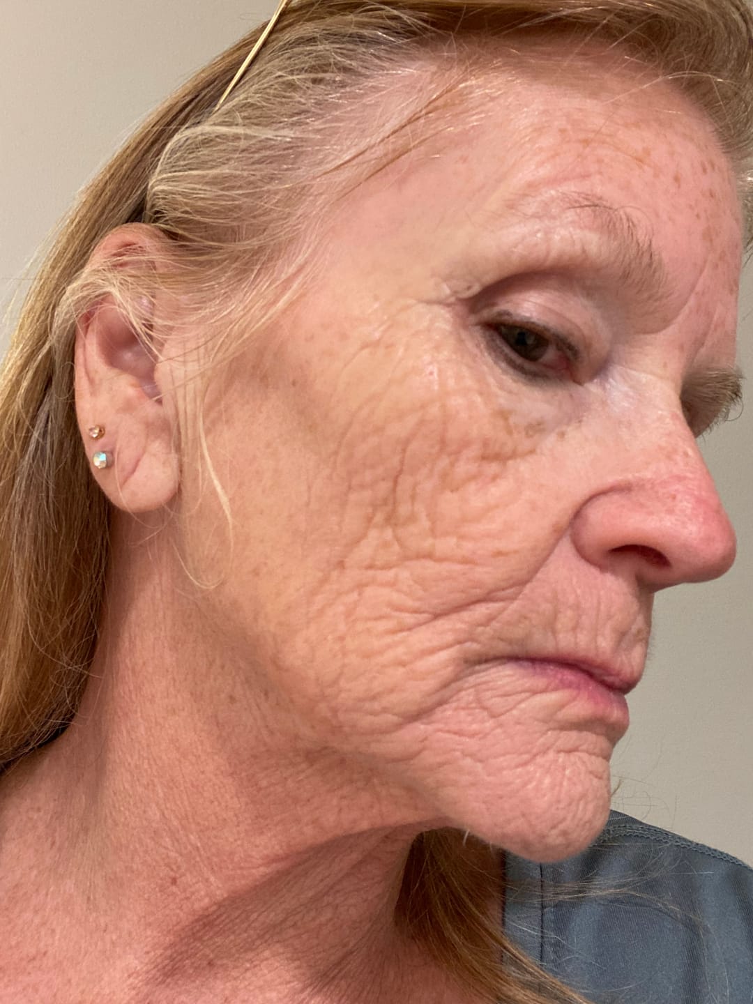 Customer photo review of Deep Collagen Cream