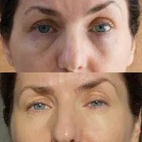 Customer photo review of [Dr.Melaxin Exclusive] Radiant Blowout Routine Set