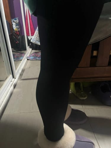 Customer photo review of Slimpur™ | Anti-Cellulite 3D-Leggings für glattere Haut & leichte Beine