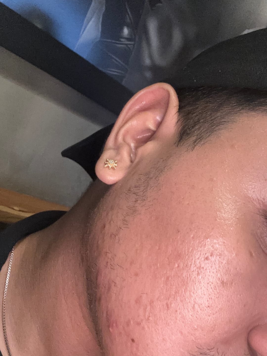 Customer photo review of Piercing sol zirconias
