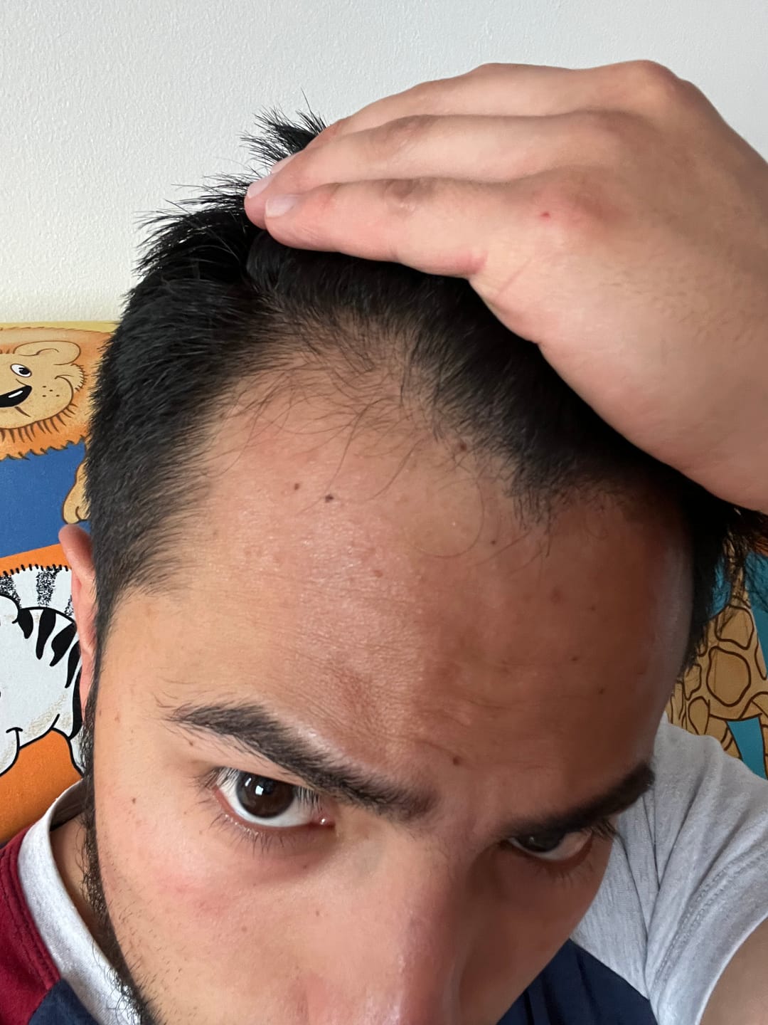 Customer photo review of Tónico Capilar de Romero  · Crecimiento y Anticaída