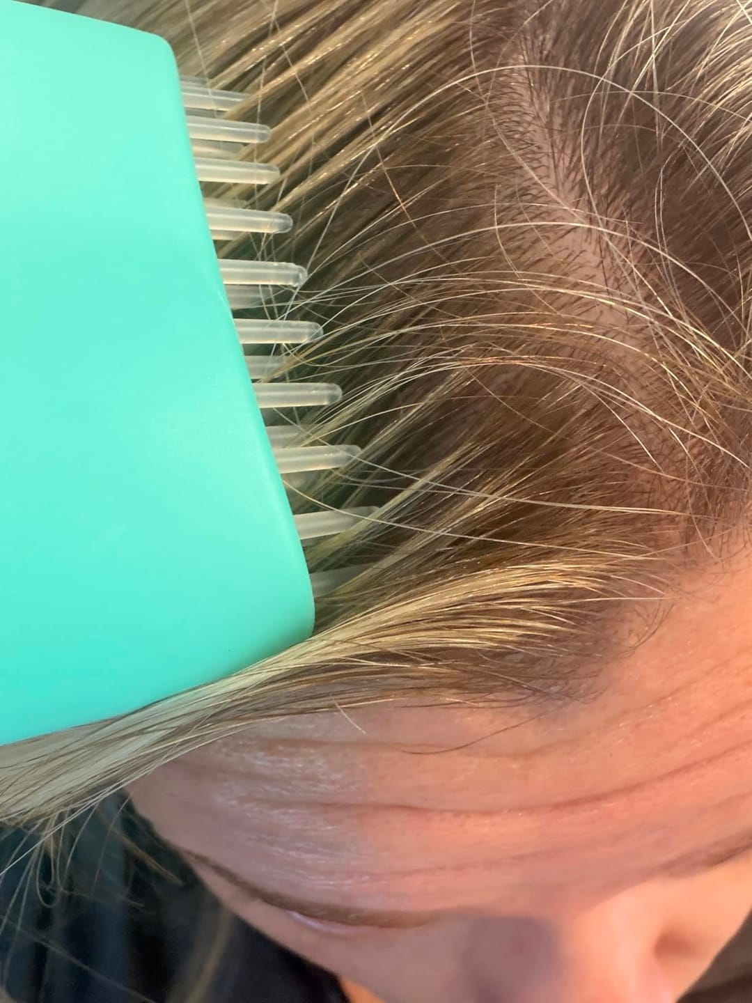 Customer photo review of PDRN Brush Hair Serum