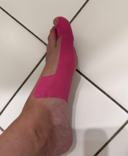 Customer photo review of Hallux-Valgus Tape - Entlastung, die auch im Schuh funktioniert