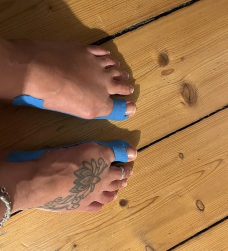 Customer photo review of Hallux-Valgus Tape - Entlastung, die auch im Schuh funktioniert