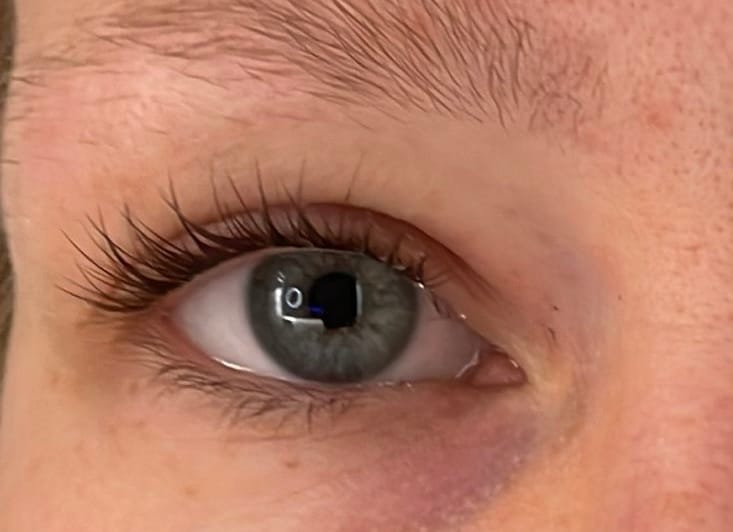 Customer photo review of Aliva - Braun
