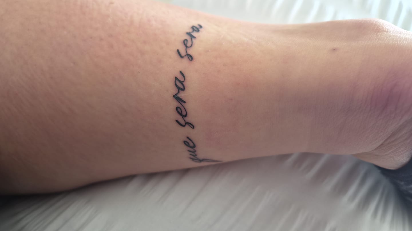 Customer photo review of TattooNumbx Numbing Cream
