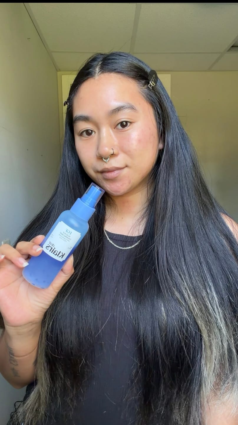 Customer photo review of Blue EGF Calming Mist