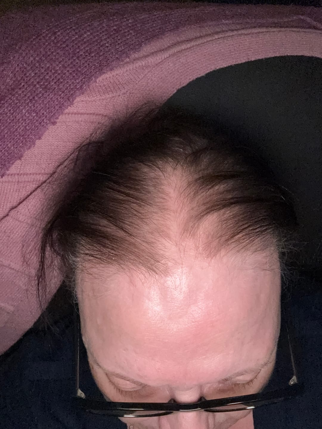 Customer photo review of Natural rosemary serum — Targeted root care between washes