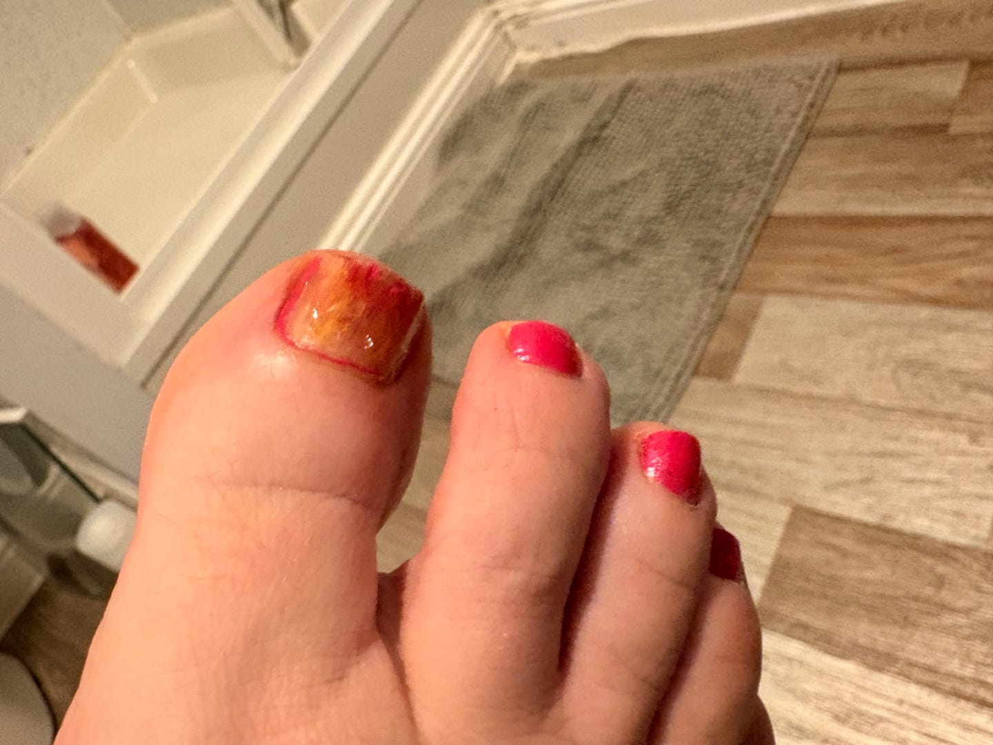 Customer photo review of Fungal Freedom