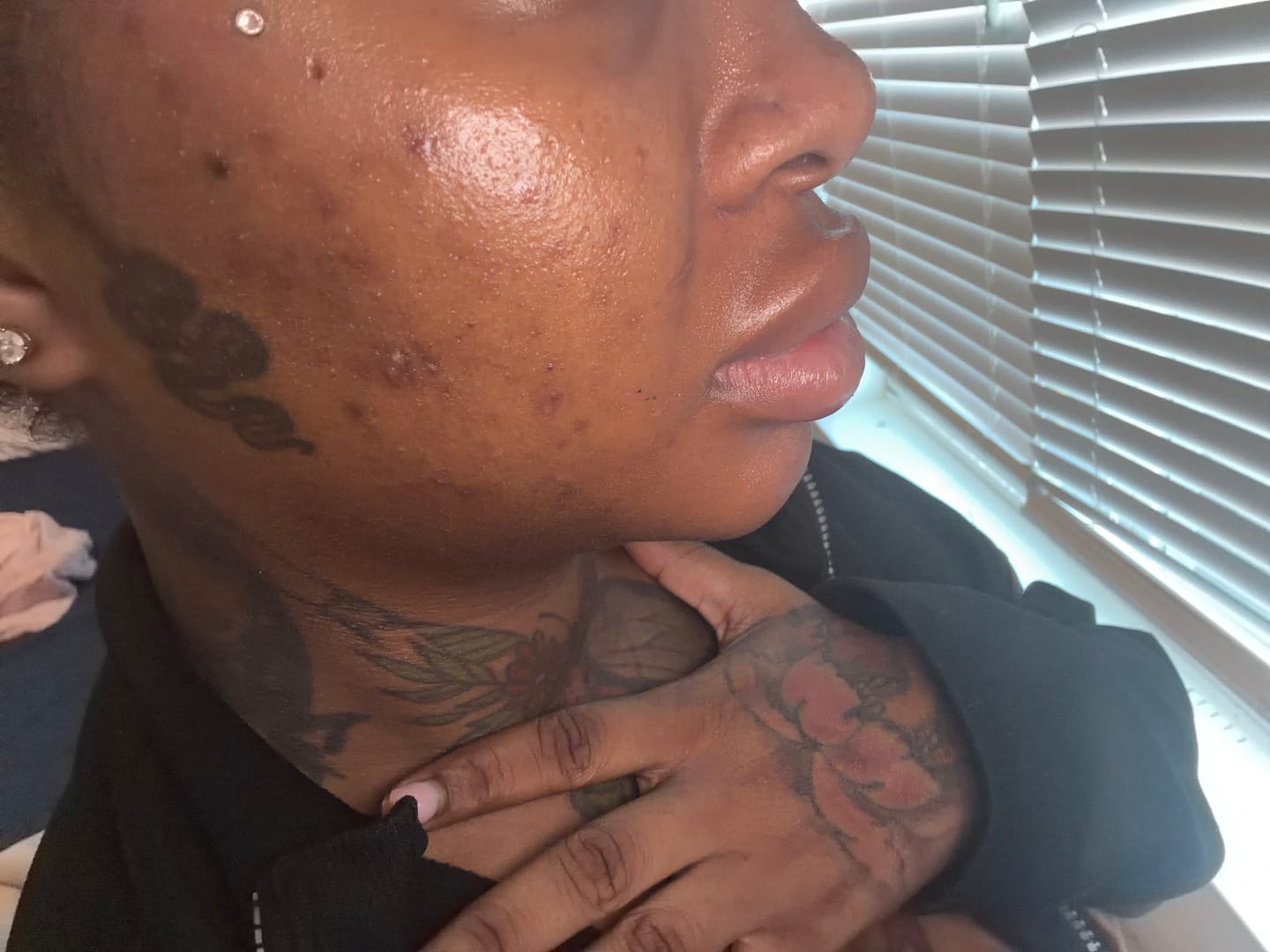 Customer photo review of Melanin Skin Bundle