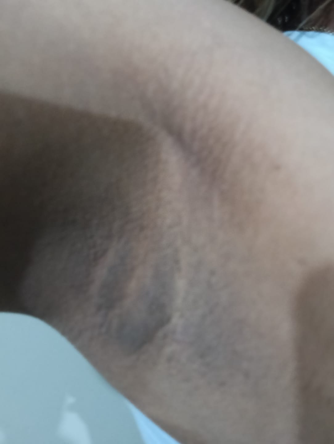 Customer photo review of Crema Aclarante Skinglow