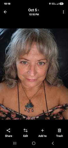 Reviewer showing their natural, glowing skin after using The Micro Infusion System treatment.