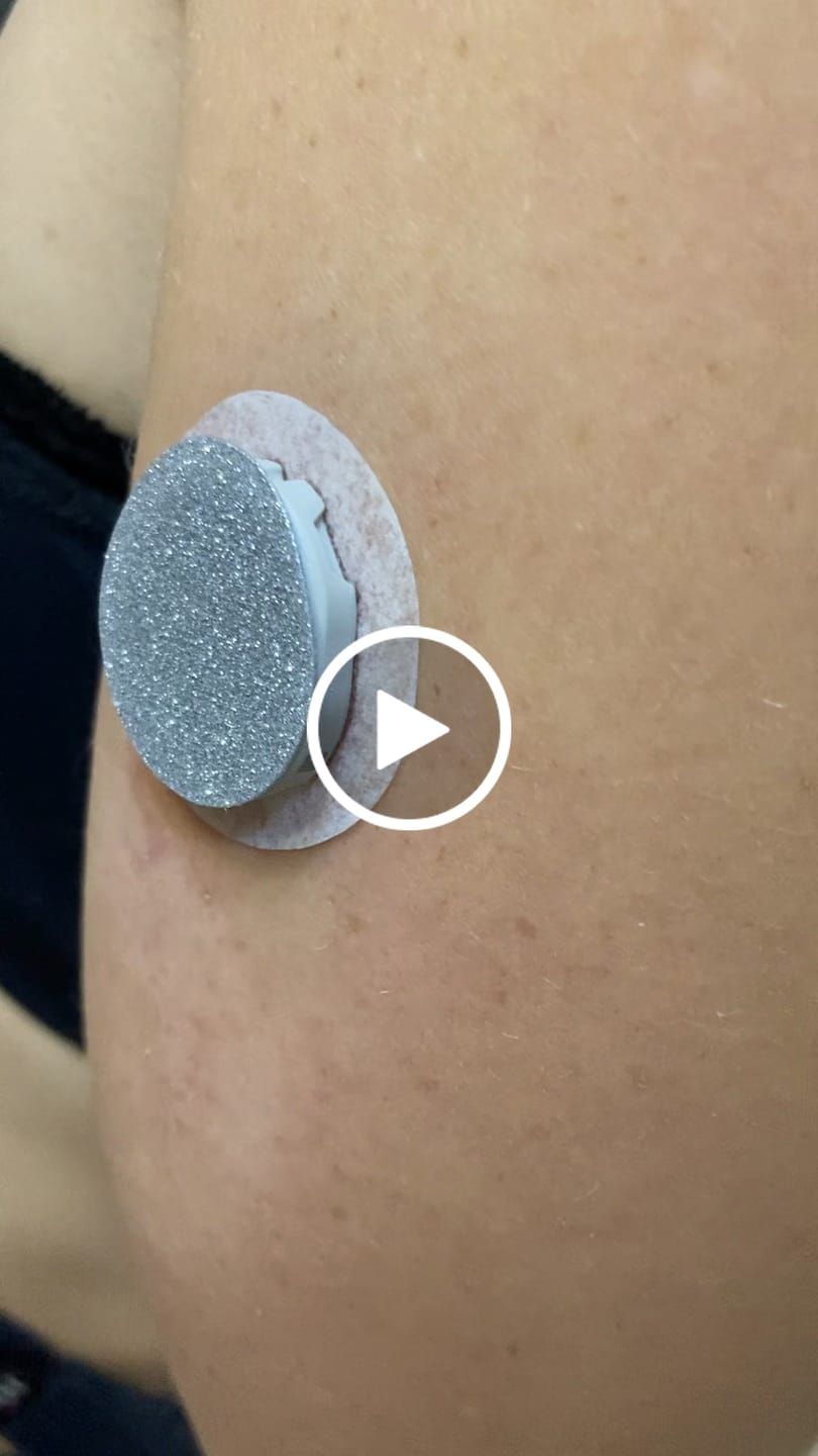 Customer video review of Dexcom G7 Glitterstickers - Färgglada Stickers för CGM-Sensor
