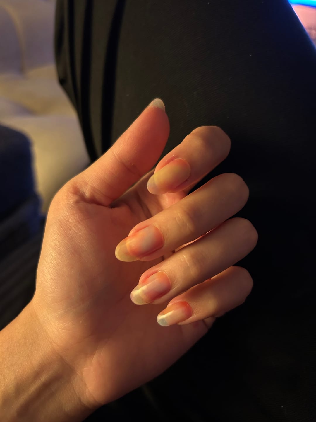 Customer photo review of N Floral Fantasy Jel Tırnak 30 Adet, 2 Kullanım