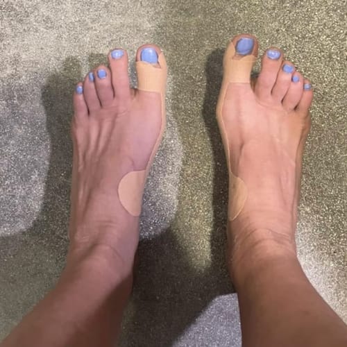 Customer photo review of Hallux-Valgus Tape - Entlastung, die auch im Schuh funktioniert