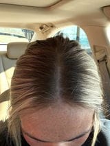 Customer photo review of Capelli più lunghi, forti e folti in 6 settimane