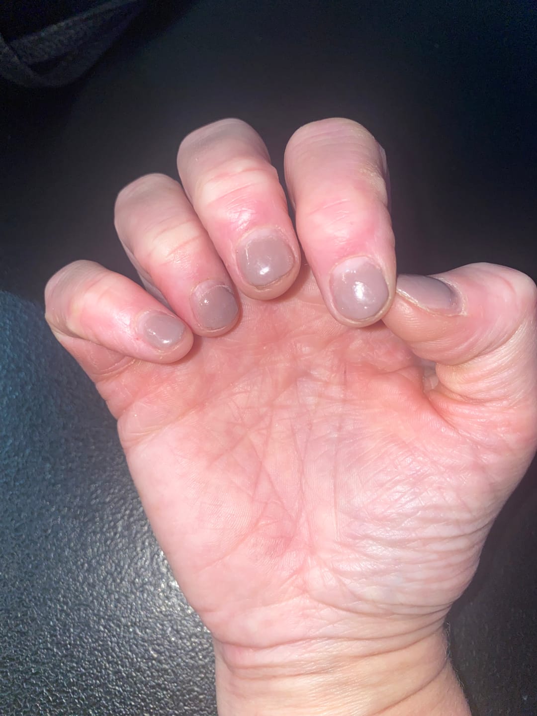 Customer photo review of Glowdip Alles-in-één Manicure Set