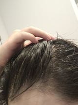 Customer photo review of Capelli più lunghi, forti e folti in 6 settimane
