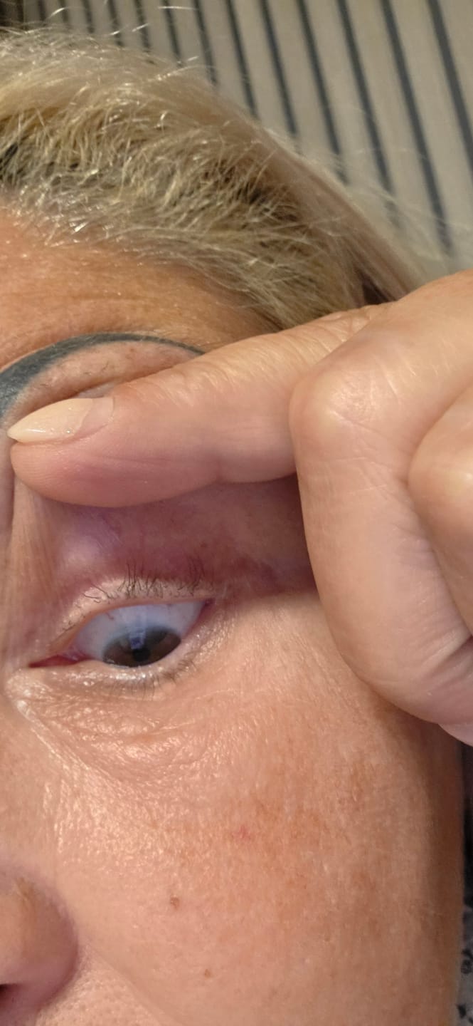 Customer photo review of Eyelash Serum