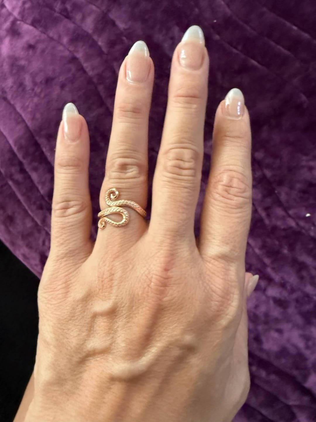Customer photo review of Octopus Tentacle Bypass Ring