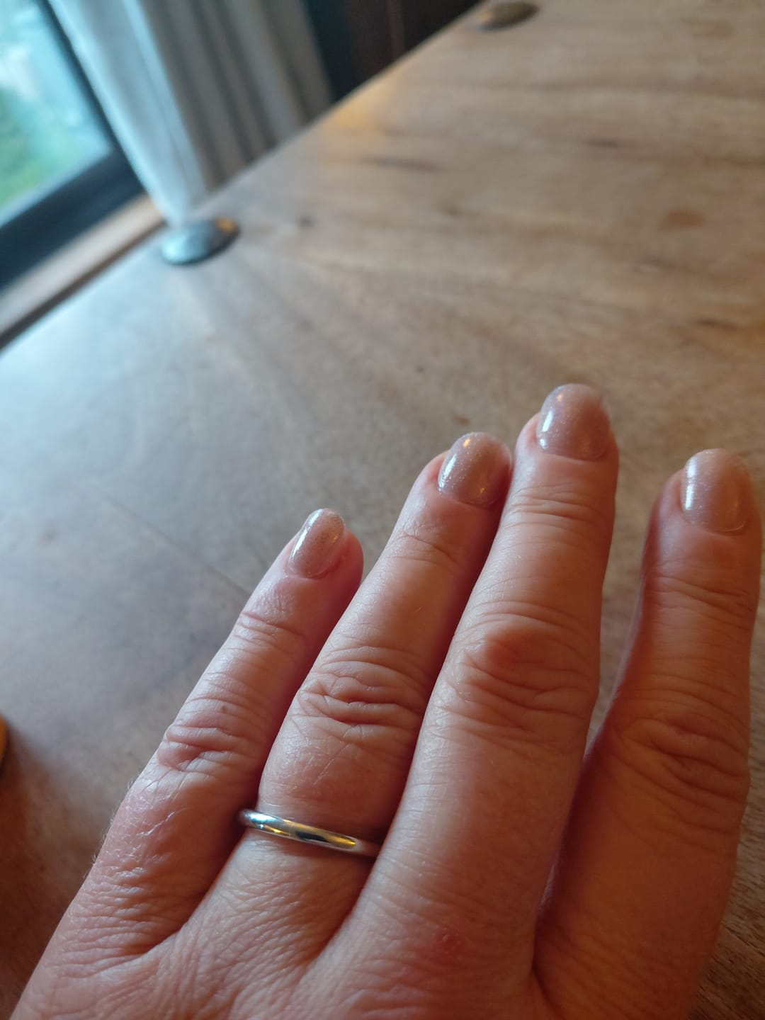 Customer photo review of White Gold 2mm Wonder Ring