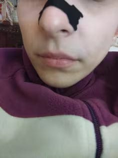 Customer photo review of Nasenpflaster schwarz: für erholsamen Schlaf und Sport