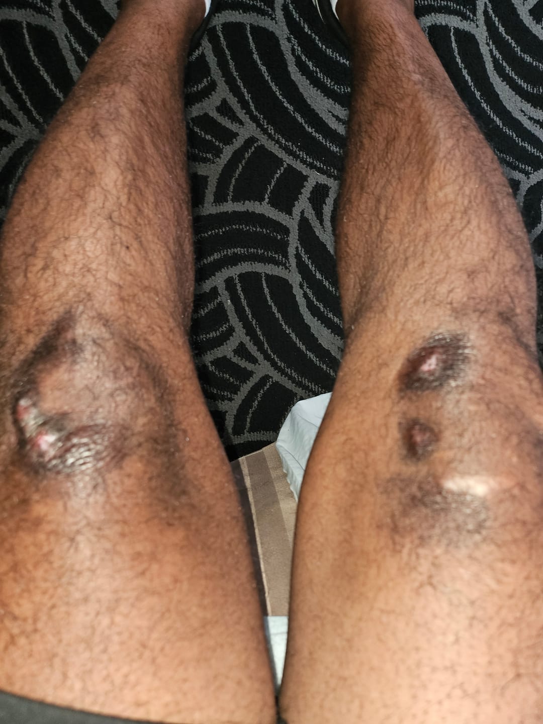 Customer photo review of Extra Strength Sweet Ginger Vapor Rub [Compact]