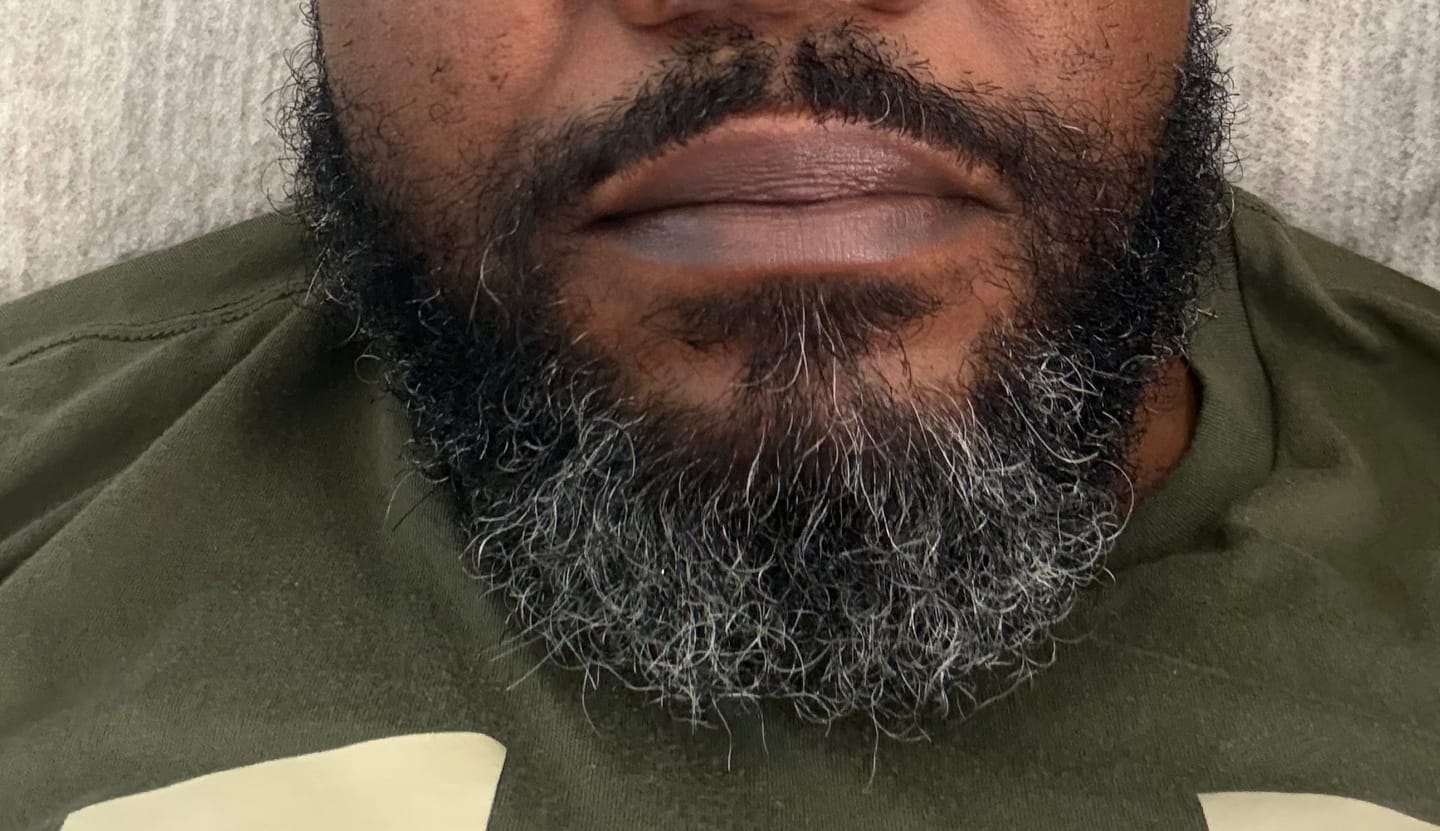 Customer photo review of Beard Shampoo