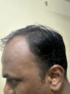 Customer photo review of Blinqo 2-in-1 Hair Colour Touch-Up Stick with Comb | Instant Grey Hair Coverage (20g)