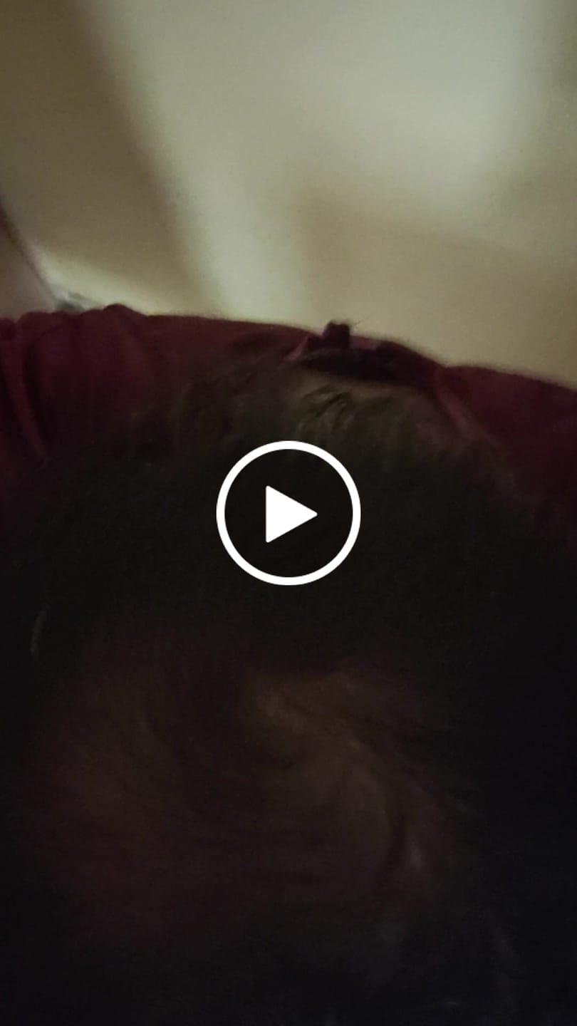 Customer video review of Minoxidil 5 mg con 90 tabletas para 3 meses de tratamiento