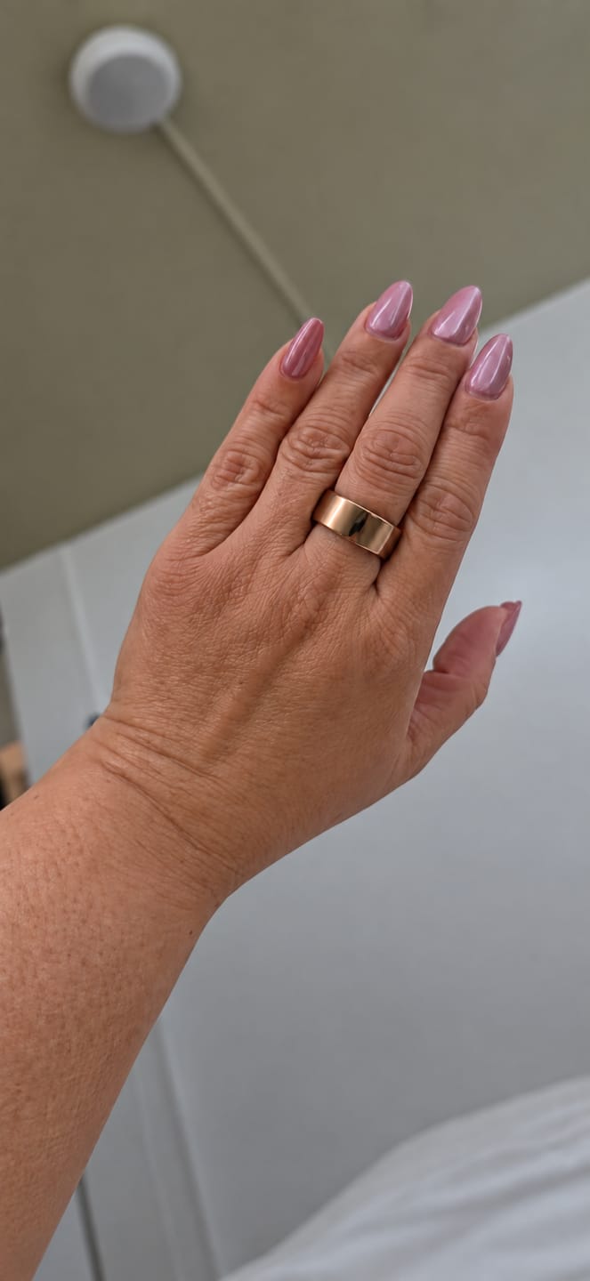 Customer photo review of Suna Ring 5