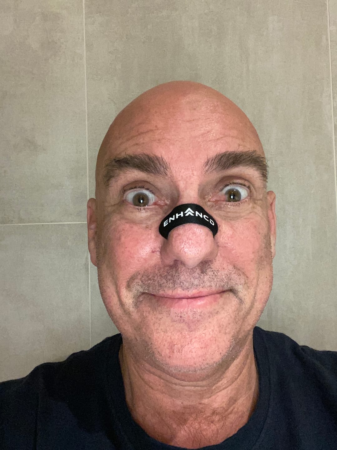 Customer photo review of Nasal Strips