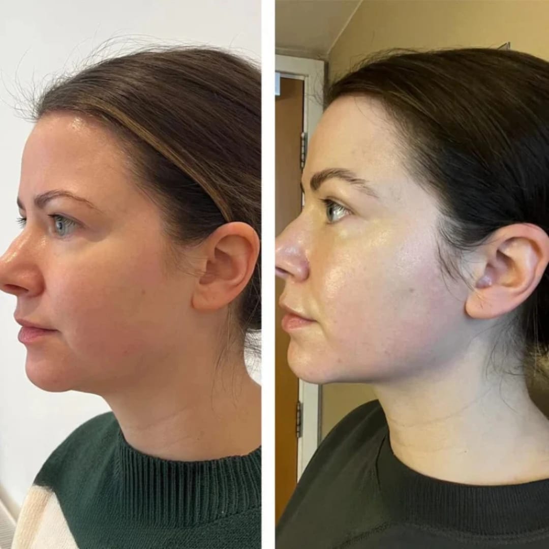 Customer photo review of Drenaje Linfático Gotas Naturales